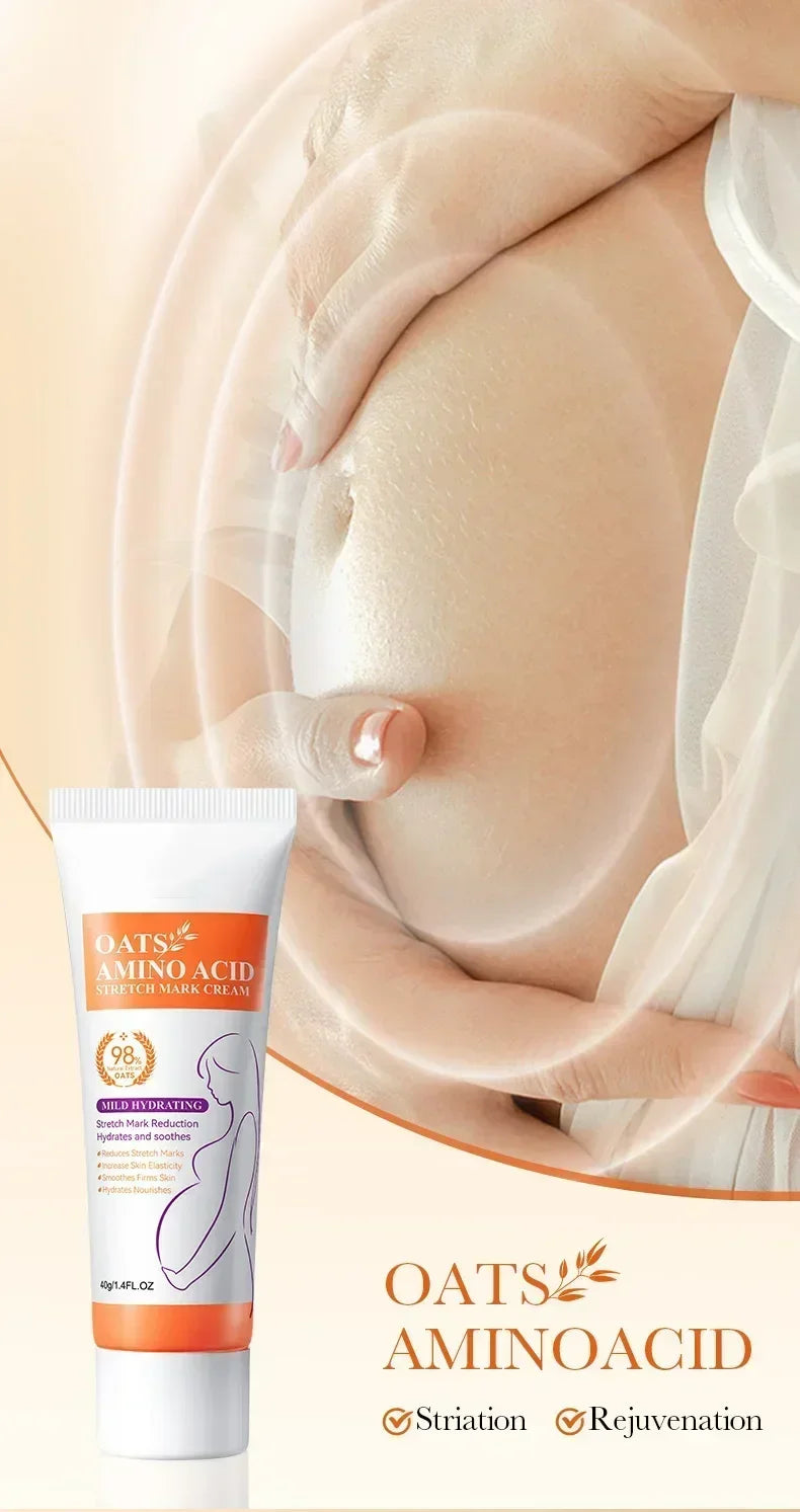 Crème Effacement Vergetures Rouges & Blanches – Anciennes & Récentes | Soin Grossesse & Post-Partum