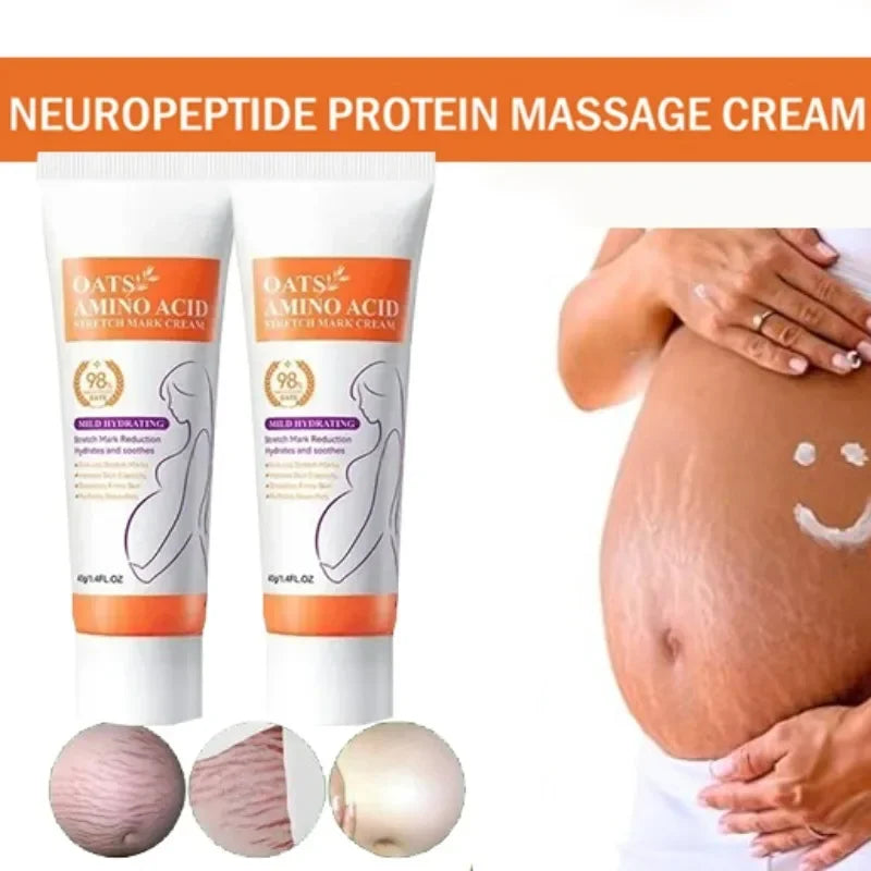 Crème Effacement Vergetures Rouges & Blanches – Anciennes & Récentes | Soin Grossesse & Post-Partum