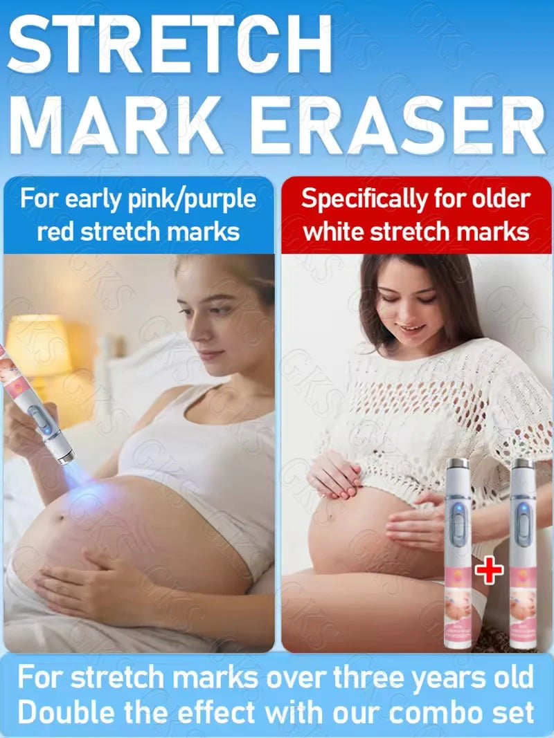 Appareil Laser Anti-Vergetures — Stylo Lumière Bleue Soin Peau Maternité & Post-Partum