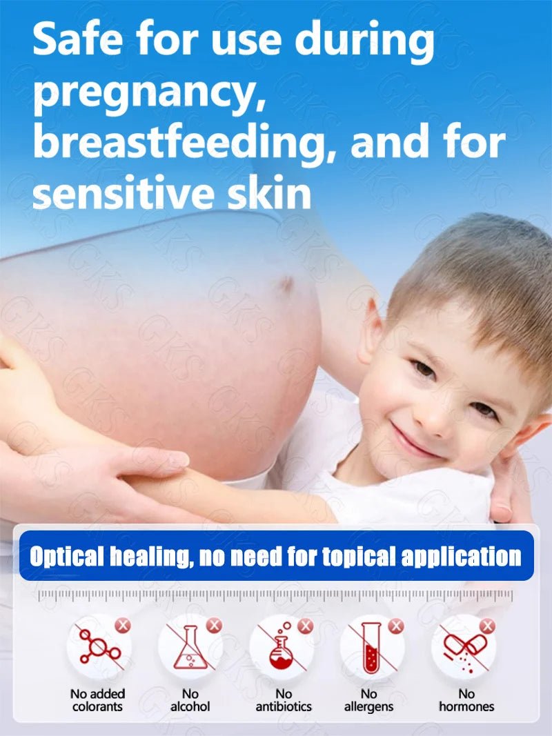 Appareil Laser Anti-Vergetures — Stylo Lumière Bleue Soin Peau Maternité & Post-Partum