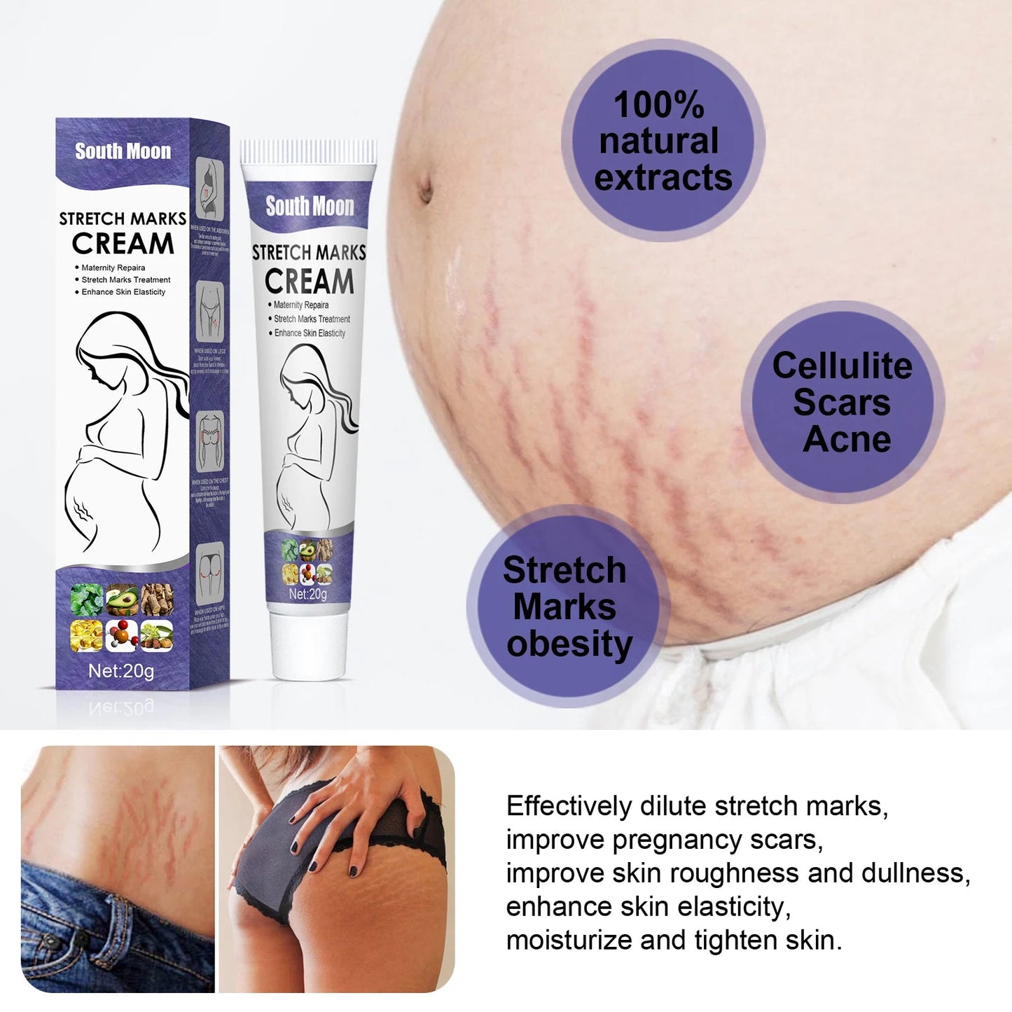Crème Anti-Vergetures Grossesse – Hydratante, Raffermissante & Élasticité | Soin Peau Femme Enceinte