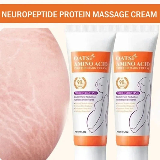 Crème Effacement Vergetures Rouges & Blanches – Anciennes & Récentes | Soin Grossesse & Post-Partum