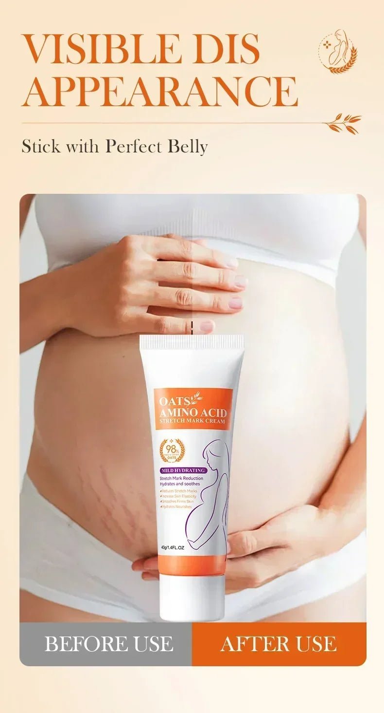 Crème Effacement Vergetures Rouges & Blanches – Anciennes & Récentes | Soin Grossesse & Post-Partum